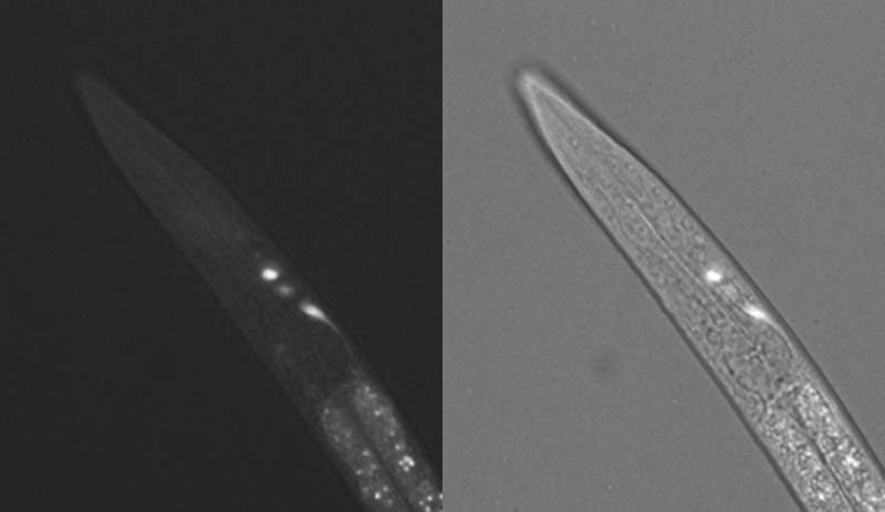 Gene: ZK973.11, Strain: BC15430, Stage: Larval